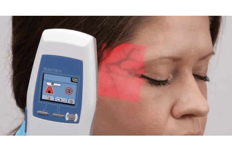 Enhancing Safety in Cosmetic Filler Injections with Accuvein