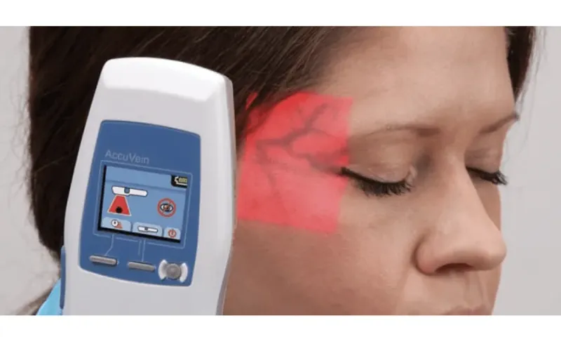 Enhancing Safety in Cosmetic Filler Injections with Accuvein