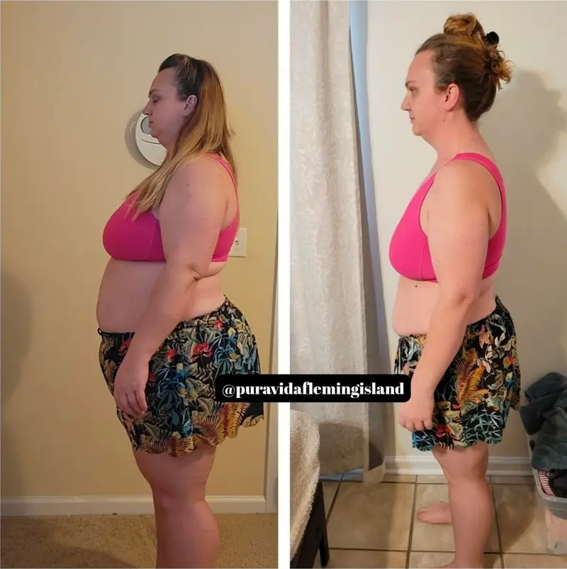 Before and after medical weight loss on a supervised plan