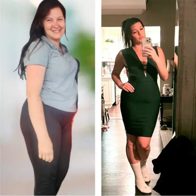 Before and after medical weight loss showing a healthier silhouette