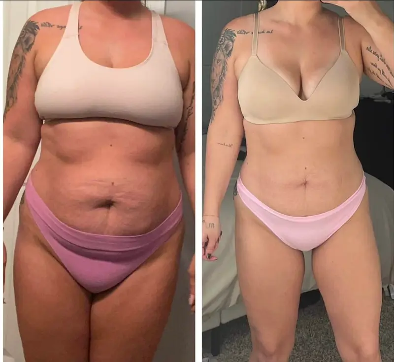 Before and after medical weight loss guided by the clinical team